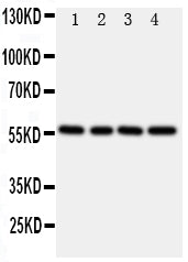 Anti-TXNRD2 Antibody Picoband® Boster Bio