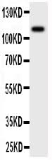 Anti-MCSF Receptor/CSF1R Antibody Picoband® Boster Bio