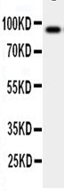 Anti-GCSF Receptor/CSF3R Antibody Picoband® Boster Bio