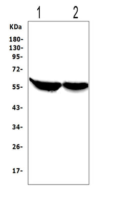 Anti-Cytochrome P450 2E1/CYP2E1 Antibody Picoband® Boster Bio