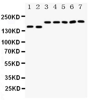 Anti-Netrin receptor DCC DCC Antibody Picoband® Boster Bio