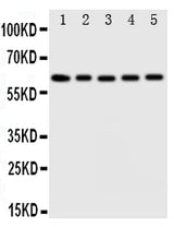 Anti-Iduronate 2 sulfatase/IDS Antibody Picoband® Boster Bio