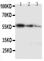 Anti-Ki67/MKI67 Antibody Picoband® Boster Bio