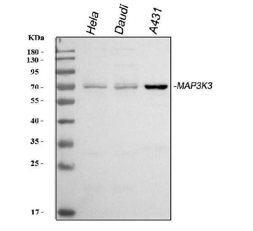 Anti-MEKK3/MAP3K3 Antibody Picoband® Boster Bio