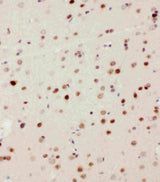 Anti-MEKK3/MAP3K3 Antibody Picoband® Boster Bio