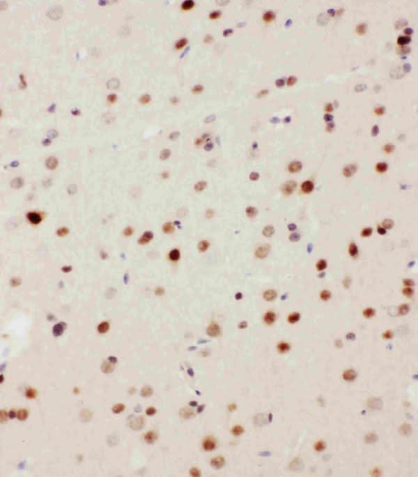 Anti-MEKK3/MAP3K3 Antibody Picoband® Boster Bio