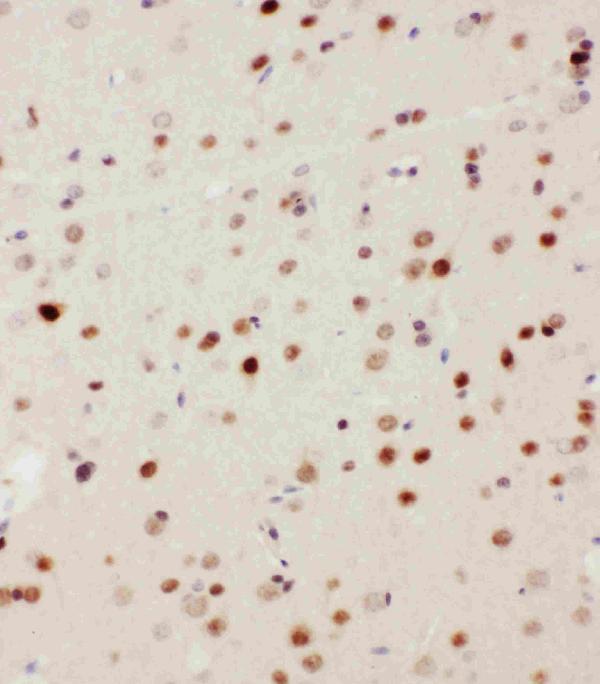 Anti-MEKK3/MAP3K3 Antibody Picoband® Boster Bio