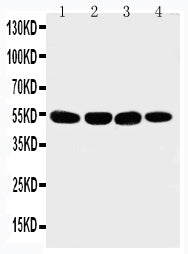 Anti-Matrilin 3/MATN3 Antibody Picoband® Boster Bio