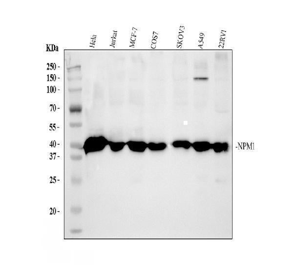 Anti-Nucleophosmin/NPM1 Antibody Picoband® Boster Bio