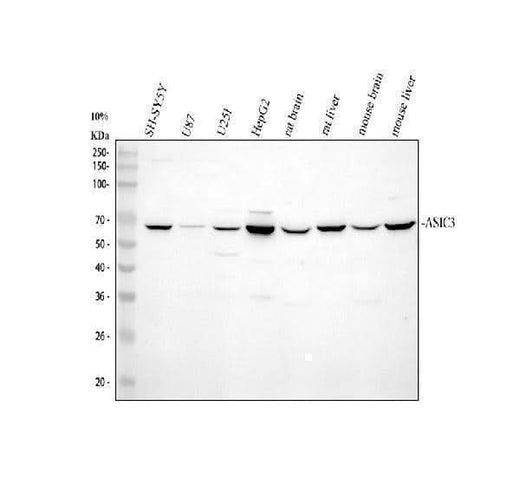 Anti-Acid-sensing ion channel 3 ASIC3 Antibody Picoband® Boster Bio