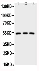 Anti-IRAK4 Antibody Picoband® Boster Bio