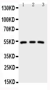 Anti-IRAK4 Antibody Picoband® Boster Bio