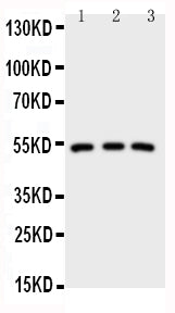 Anti-IRAK4 Antibody Picoband® Boster Bio