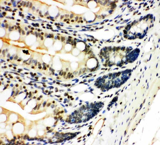Anti-NFkB/NFKB2 p100/p52 Antibody Picoband® Boster Bio