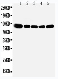 Anti-OSBP1 Antibody Picoband® Boster Bio