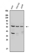 Anti-SQSTM1/p62 Antibody Picoband® Boster Bio