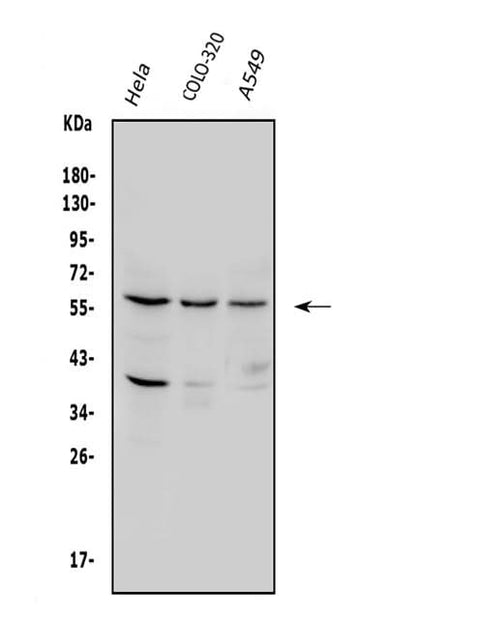 Anti-SQSTM1/p62 Antibody Picoband® Boster Bio