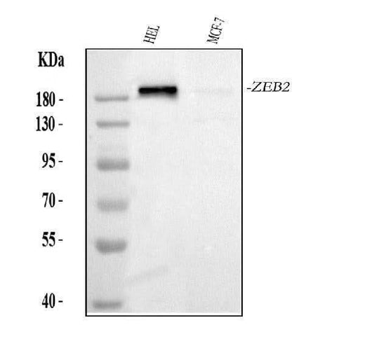 Anti-Smad Interacting Protein 1/ZEB2 Antibody Picoband® Boster Bio