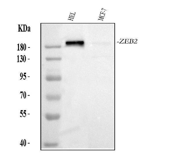 Anti-Smad Interacting Protein 1/ZEB2 Antibody Picoband® Boster Bio