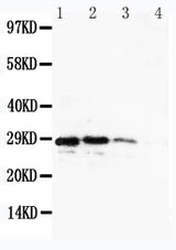 Anti-CUEDC2 Antibody Picoband® Boster Bio