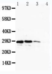 Anti-CUEDC2 Antibody Picoband® Boster Bio