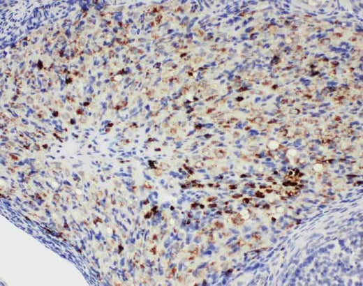Anti-DDX4/MVH Antibody Picoband® Boster Bio
