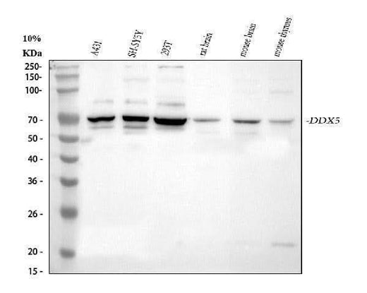 Anti-DDX5 Antibody Picoband® Boster Bio