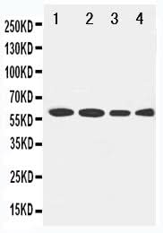 Anti-LCAT Antibody Picoband® Boster Bio