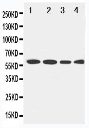 Anti-LCAT Antibody Picoband® Boster Bio