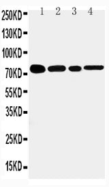 Anti-TNF Receptor II/TNFRSF1B Antibody Picoband® Boster Bio