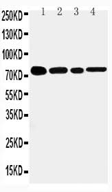 Anti-TNF Receptor II/TNFRSF1B Antibody Picoband® Boster Bio
