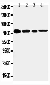 Anti-TNF Receptor II/TNFRSF1B Antibody Picoband® Boster Bio