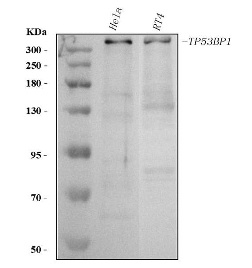 Anti-53BP1/TP53BP1 Antibody Picoband® Boster Bio