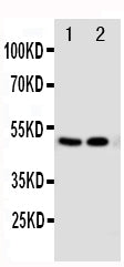 Anti-Vitamin D Receptor/VDR Antibody Picoband® Boster Bio