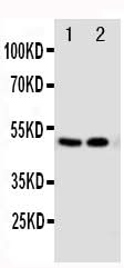 Anti-Vitamin D Receptor/VDR Antibody Picoband® Boster Bio