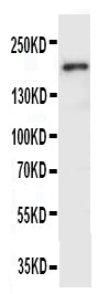 Anti-VEGF Receptor 2/KDR Antibody Picoband® Boster Bio