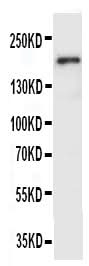 Anti-VEGF Receptor 2/KDR Antibody Picoband® Boster Bio
