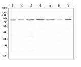 Anti-LTK Antibody Picoband® Boster Bio
