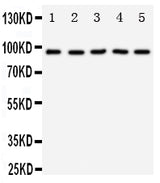 Anti-TrkC/NTRK3 Antibody Picoband® Boster Bio