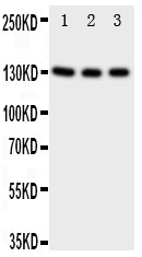 Anti-TrkC/NTRK3 Antibody Picoband® Boster Bio