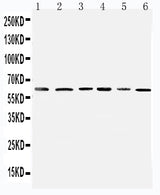 Anti-Mitochondrial Pyruvate dehydrogenase kinase 1/PDK1 Antibody Picoband® Boster Bio