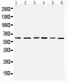 Anti-Mitochondrial Pyruvate dehydrogenase kinase 1/PDK1 Antibody Picoband® Boster Bio