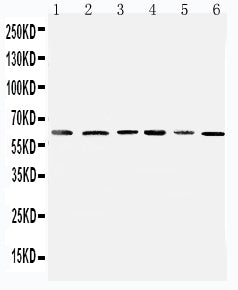Anti-Mitochondrial Pyruvate dehydrogenase kinase 1/PDK1 Antibody Picoband® Boster Bio