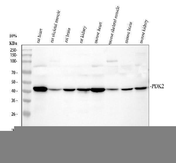 Anti-PDK2 Antibody Picoband® Boster Bio