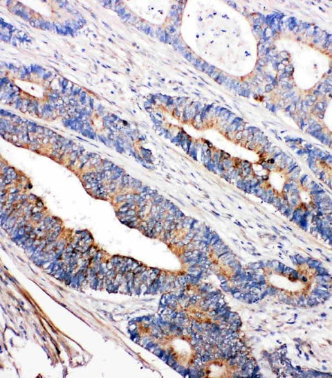 Anti-Tyrosine-protein kinase Tec Tec Antibody Picoband® Boster Bio