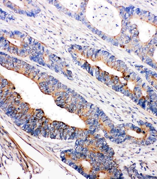 Anti-Tyrosine-protein kinase Tec Tec Antibody Picoband® Boster Bio