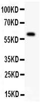 Anti-DR3/TNFRSF25 Antibody Picoband® Boster Bio