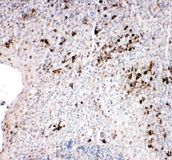 Anti-TRAF2 Antibody Picoband® Boster Bio