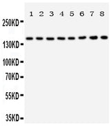 Anti-Hamartin/TSC1 Antibody Picoband® Boster Bio