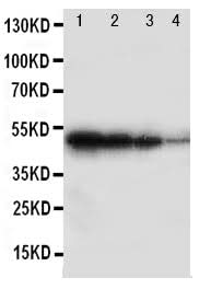 Anti-BMPR1B Antibody Picoband® Boster Bio